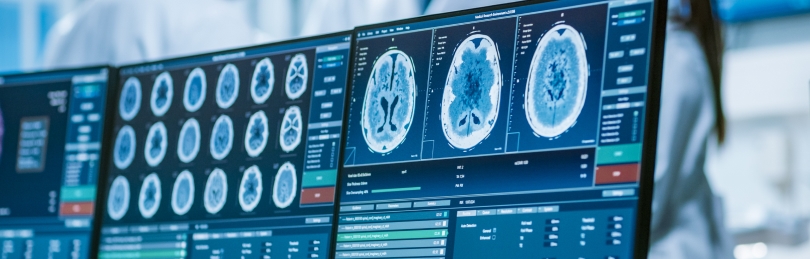 traumatic brain injuries
