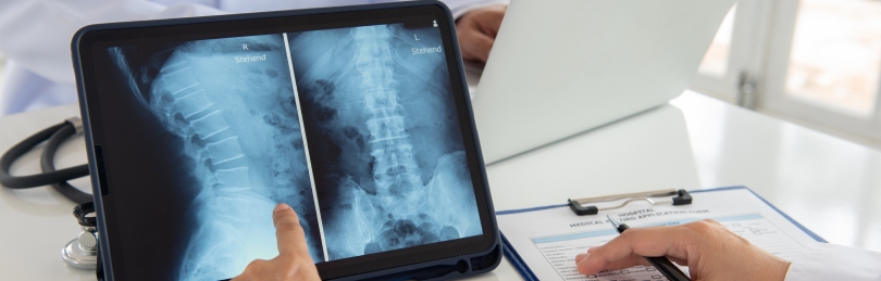spinal cord injuries